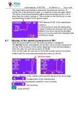 Preview for 19 page of ATYS MEDICAL SysToe User Manual