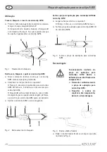 Предварительный просмотр 30 страницы B. Braun AESCULAP AVM Instructions For Use Manual