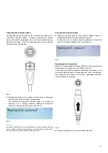 Предварительный просмотр 155 страницы B. Braun Aesculap Lektrafuse GN200 Instructions For Use Manual