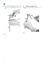 Предварительный просмотр 10 страницы B. Braun Aesculap MINOP InVent trocar Instructions For Use/Technical Description