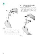 Предварительный просмотр 12 страницы B. Braun Aesculap MINOP InVent trocar Instructions For Use/Technical Description