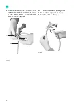 Предварительный просмотр 62 страницы B. Braun Aesculap MINOP InVent trocar Instructions For Use/Technical Description