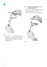 Предварительный просмотр 140 страницы B. Braun Aesculap MINOP InVent trocar Instructions For Use/Technical Description