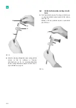 Предварительный просмотр 172 страницы B. Braun Aesculap MINOP InVent trocar Instructions For Use/Technical Description