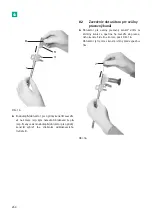 Предварительный просмотр 256 страницы B. Braun Aesculap MINOP InVent trocar Instructions For Use/Technical Description