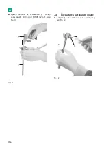 Предварительный просмотр 318 страницы B. Braun Aesculap MINOP InVent trocar Instructions For Use/Technical Description