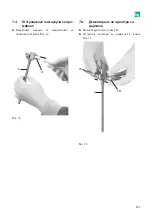 Предварительный просмотр 335 страницы B. Braun Aesculap MINOP InVent trocar Instructions For Use/Technical Description