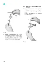 Предварительный просмотр 370 страницы B. Braun Aesculap MINOP InVent trocar Instructions For Use/Technical Description