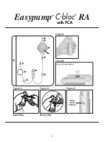 Предварительный просмотр 4 страницы B. Braun Easypump C-bloc  RA Manual