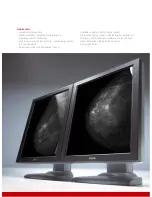 Предварительный просмотр 3 страницы Barco Coronis 5MP Mammo Brochure & Specs