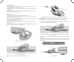 Preview for 79 page of Bard Peripheral Vascular LifeStent 5F Instructions For Use Manual