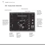 Preview for 20 page of Bard 9770000 Instructions For Use Manual