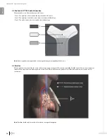 Preview for 16 page of Bard Sherlock 3CG Instructions For Use Manual