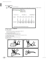 Preview for 20 page of Bard Sherlock 3CG Instructions For Use Manual