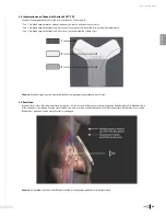 Preview for 71 page of Bard Sherlock 3CG Instructions For Use Manual