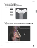 Preview for 99 page of Bard Sherlock 3CG Instructions For Use Manual