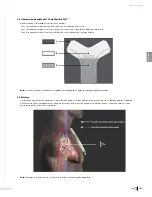 Preview for 125 page of Bard Sherlock 3CG Instructions For Use Manual