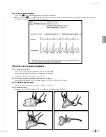 Preview for 129 page of Bard Sherlock 3CG Instructions For Use Manual