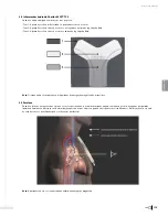 Preview for 177 page of Bard Sherlock 3CG Instructions For Use Manual