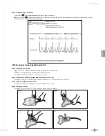 Preview for 181 page of Bard Sherlock 3CG Instructions For Use Manual