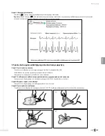 Preview for 211 page of Bard Sherlock 3CG Instructions For Use Manual