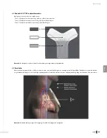 Preview for 235 page of Bard Sherlock 3CG Instructions For Use Manual