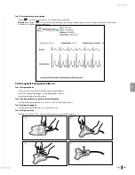 Preview for 239 page of Bard Sherlock 3CG Instructions For Use Manual