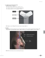 Preview for 261 page of Bard Sherlock 3CG Instructions For Use Manual