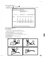 Preview for 291 page of Bard Sherlock 3CG Instructions For Use Manual