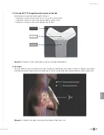 Preview for 339 page of Bard Sherlock 3CG Instructions For Use Manual