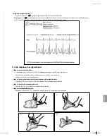 Preview for 343 page of Bard Sherlock 3CG Instructions For Use Manual