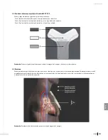 Preview for 365 page of Bard Sherlock 3CG Instructions For Use Manual