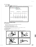 Preview for 369 page of Bard Sherlock 3CG Instructions For Use Manual