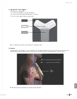 Preview for 419 page of Bard Sherlock 3CG Instructions For Use Manual