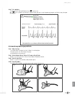 Preview for 423 page of Bard Sherlock 3CG Instructions For Use Manual