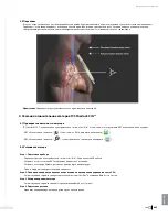 Preview for 447 page of Bard Sherlock 3CG Instructions For Use Manual