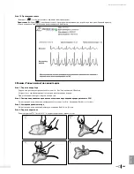 Preview for 451 page of Bard Sherlock 3CG Instructions For Use Manual