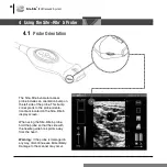 Preview for 27 page of Bard Site-Rite 5 Instructions For Use Manual