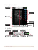 Preview for 18 page of Bard Site-Rite 8 Instructions For Use Manual