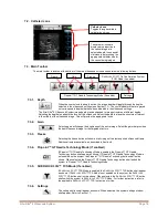 Preview for 20 page of Bard Site-Rite 8 Instructions For Use Manual