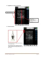 Preview for 21 page of Bard Site-Rite 8 Instructions For Use Manual