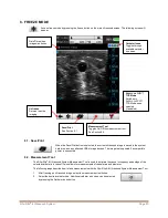 Preview for 22 page of Bard Site-Rite 8 Instructions For Use Manual