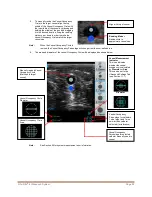 Preview for 24 page of Bard Site-Rite 8 Instructions For Use Manual