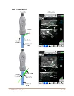 Preview for 31 page of Bard Site-Rite 8 Instructions For Use Manual