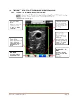 Preview for 32 page of Bard Site-Rite 8 Instructions For Use Manual