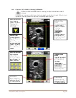 Preview for 33 page of Bard Site-Rite 8 Instructions For Use Manual