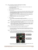 Preview for 57 page of Bard Site-Rite 8 Instructions For Use Manual