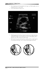 Предварительный просмотр 24 страницы Bard Site-Rite IV Manual