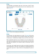 Предварительный просмотр 55 страницы Bausch OccluSense Quick Start Manual