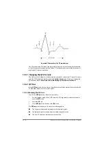 Предварительный просмотр 158 страницы BeneVision TM80 Operator'S Manual